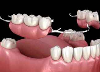 Dental Prosthetics Market: Trends, Developments, Growth Forecasts to 2031 news-08112024-015003