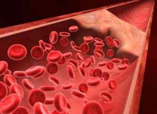 Enhancing Recovery and Reducing Complications: Hemostasis Products Market to Reach USD 4.5 Billion by 2034 news-26112024-053449